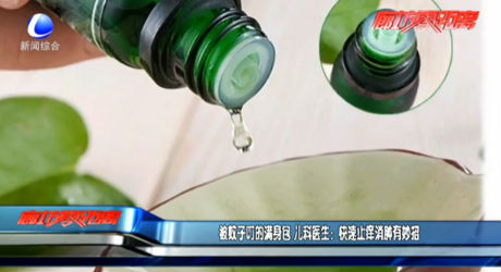 被蚊子叮的滿(mǎn)身包 兒科醫(yī)生：快速止癢消腫有妙招